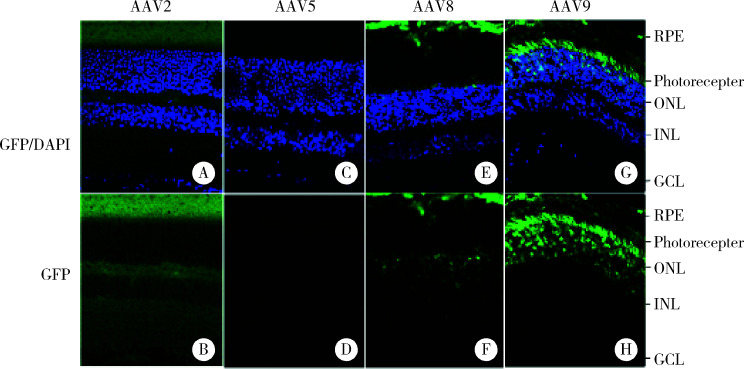 小鼠視網(wǎng)膜下腔注射不同血清型AAV病毒載體后2周的免疫gfp熒光染色